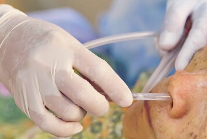 Ryles Tube Insertion At Home In Jor Bagh
